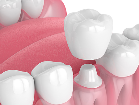 Seabreeze Dental