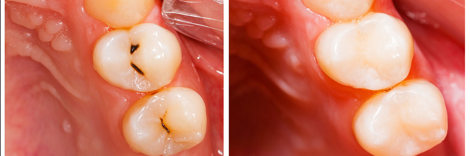 Seabreeze Dental