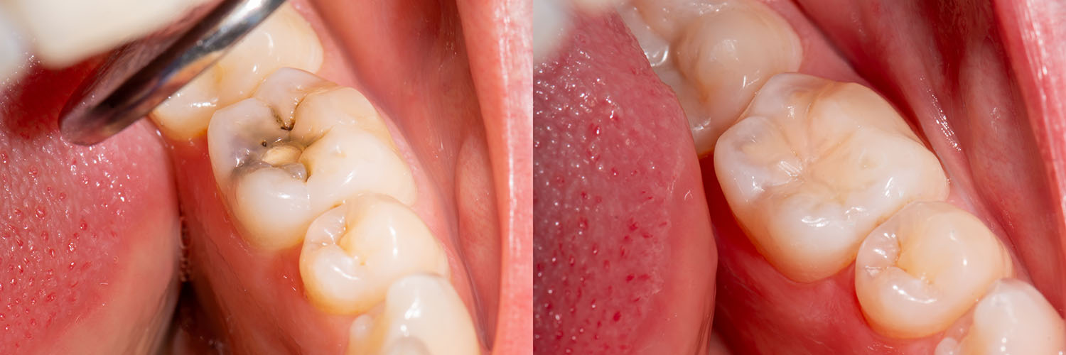 Seabreeze Dental