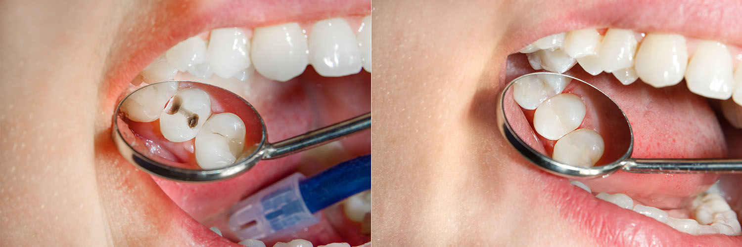 Seabreeze Dental