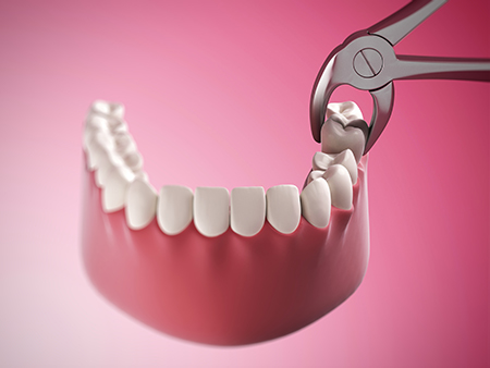 Seabreeze Dental